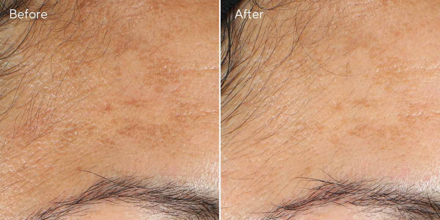 vita-c-brightening_-serum-bna-1