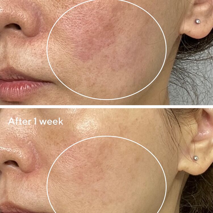 Low_Res-673700_Sensitive_Skin_Collection_Serum_SiteAsset_Asos_Carousel_4_BA