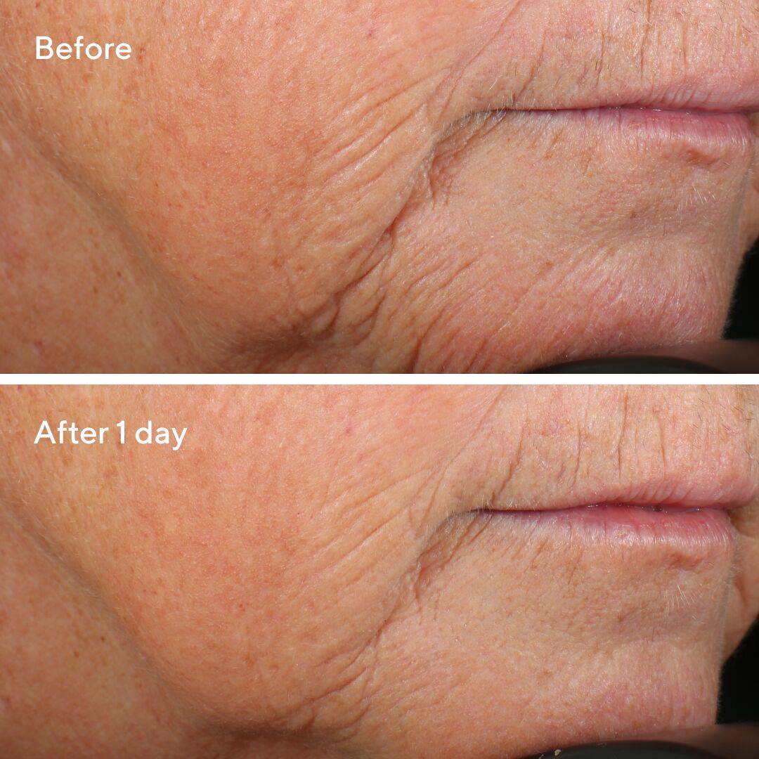 High_Res-708741_Retinal_Overnight_Cream_BA_1day_KF_Social