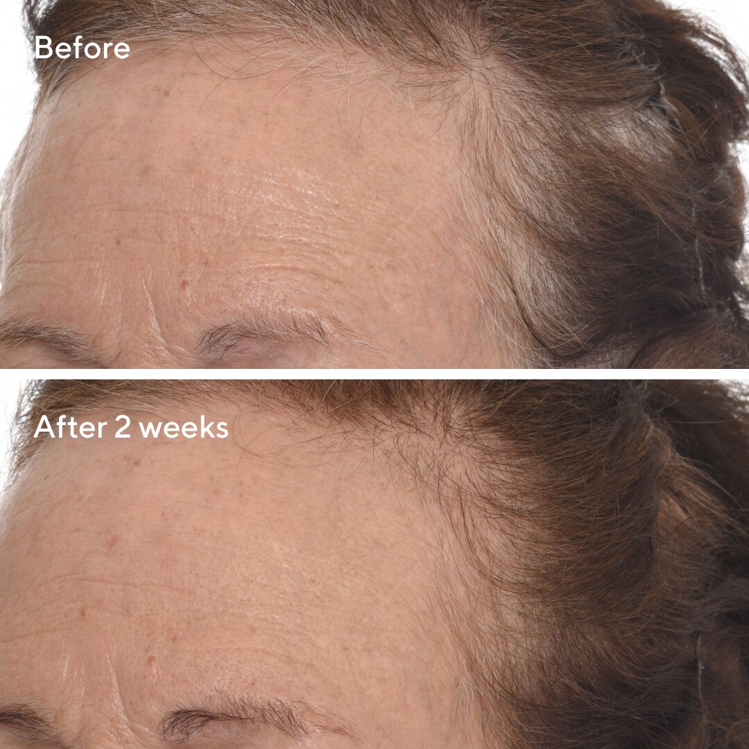 High_Res-708741_Retinal_Overnight_Cream_BA_2wks_CM_Social